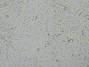 Brightfield micrograph of SK-MEL-28, adherent growth, 4X mag.