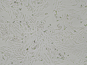 Brightfield micrograph of SK-N-AS, showing adherent growth, 4X magnification.