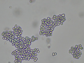 Brightfield micrograph of SKNO-1, showing suspension growth.