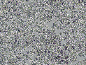 Brightfield micrograph of SUIT-2, showing adherent growth.
