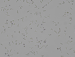 Brightfield micrograph of SW 480, showing adherent growth.