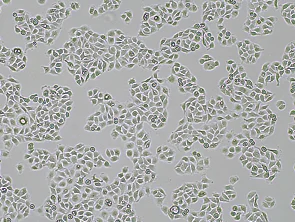 Brightfield micrograph of SW 780, showing adherent growth, 4X magnification.