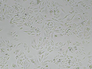 Brightfield micrograph of SW-900, showing adherent growth, 4X magnification.