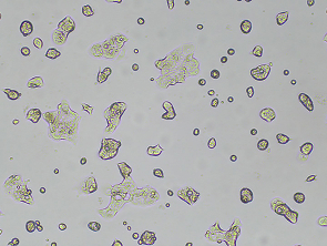 Brightfield micrograph of SW1417, showing adherent growth, 4X magnification.