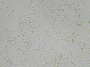 Brightfield micrograph of T24, showing adherent growth, 4X magnification.