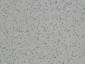 Brightfield micrograph of TALL-1, adherent growth, 4X mag.