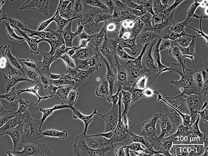 Brightfield micrograph of TCO-1, showing adherent growth.