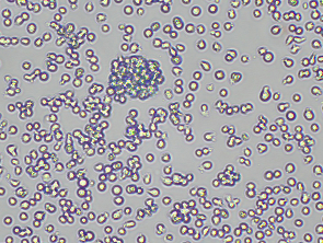 Brightfield micrograph of TK-6, showing suspension growth, 10X magnification.