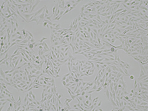 Brightfield micrograph of TM-31, showing adherent growth, 4X magnification.