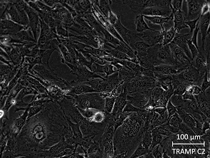 Brightfield micrograph of TRAMP C2, showing adherent growth, 20X magnification.