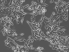Brightfield micrograph of T.T, showing adherent growth.