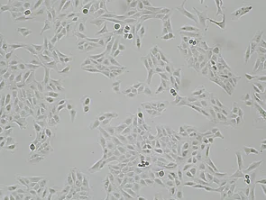 Brightfield micrograph of U-2 OS, showing adherent growth, 4X magnification.