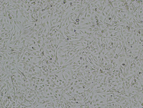 Brightfield micrograph of U-251 MG, showing adherent growth.