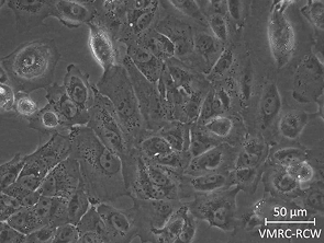 Brightfield micrograph of VMRC-RCW, showing adherent growth.