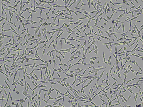 Brightfield micrograph of WM-115, showing adherent growth.