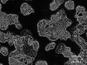 Brightfield micrograph of ZR-75-1, showing adherent growth, 20X magnification.