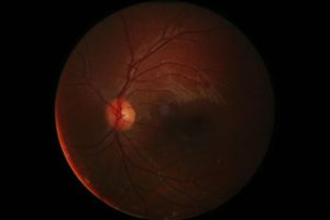 Retinal Müller Cell Line
