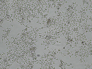 Brightfield micrograph of B16/BL6, showing adherent growth.