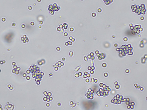 Brightfield micrograph of B95-8, showing suspension and partially adherent growth, 10X magnification.
