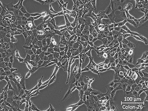 Brightfield micrograph of Colon-26, showing adherent growth.