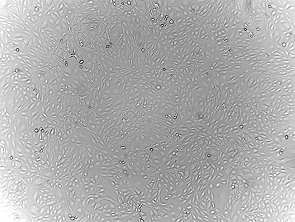 Brightfield micrograph of Human Conjunctival Epithelial Cells, showing adherent growth, 4X magnification.