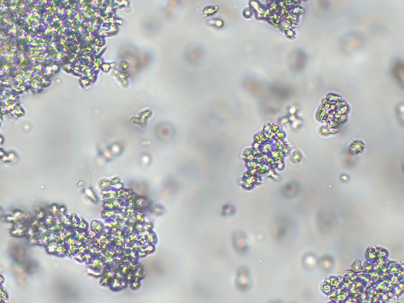 Brightfield micrograph of KHYG-1, showing suspension growth, 10X magnification.