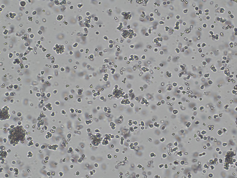Brightfield micrograph of KHYG-1, showing suspension growth, 4X magnification.