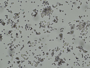 Brightfield micrograph of KMM-1, showing suspension growth.