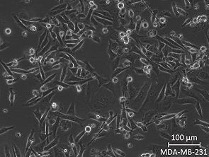 Brightfield micrograph of MDA-MB-231, showing adherent growth.