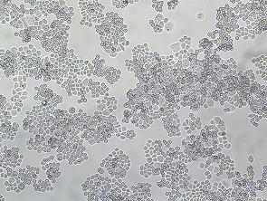 Brightfield micrograph of MDA-MB-453, showing adherent growth, 4X magnification.