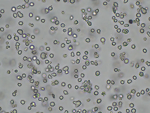 Brightfield micrograph of MONO-MAC-6, showing suspension growth.