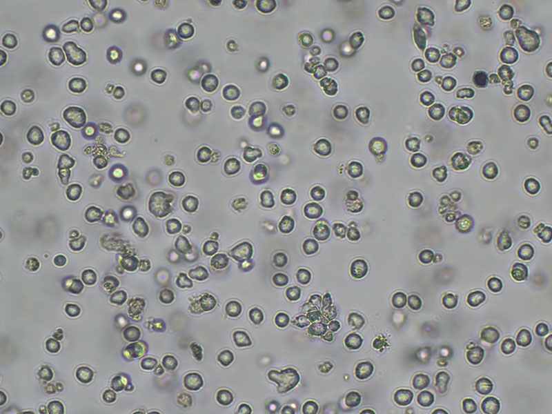 Brightfield micrograph of MONO-MAC-6, showing suspension growth, 10X magnification.