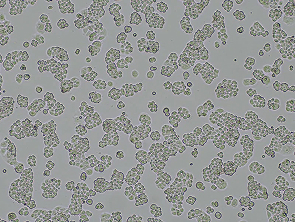 Brightfield micrograph of OVSAHO, showing adherent growth.