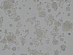 Brightfield micrograph of QGP-1, showing adherent growth.