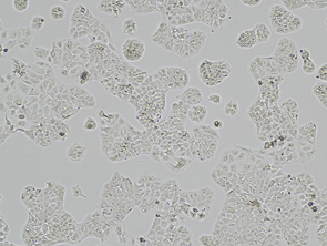 Brightfield micrograph of huH-1, showing adherent growth.