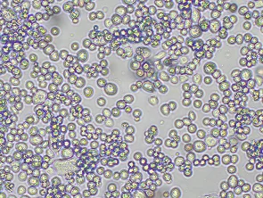 Brightfield micrograph of NUGC-4, showing adherent growth, 10X magnification.