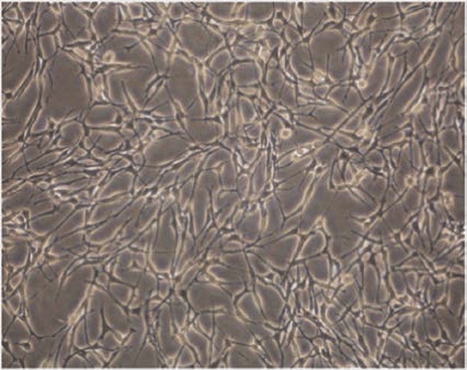 The morphology of cultured Schwann cells