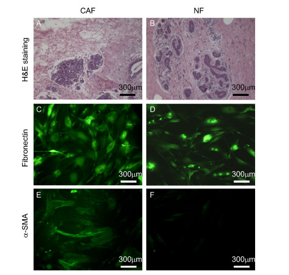 Characterization of CAFs and normal fibroblasts (NFs)