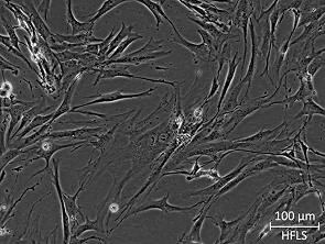 Brightfield micrograph of normal adult Human Fibroblast-Like Synoviocytes, showing adherent growth.