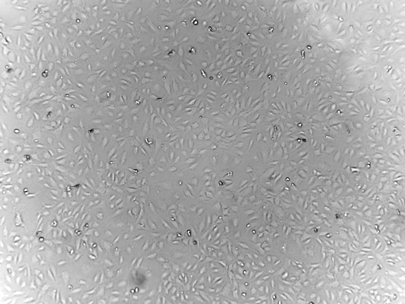 Brightfield micrograph of Human Skeletal Muscle Microvascular Endothelial Cells, showing adherent growth, 4X magnification.