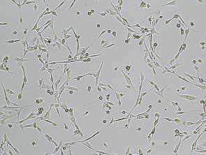Brightfield micrograph of Immortalized Human Intestine Fibroblasts, showing adherent growth, 4X magnification.