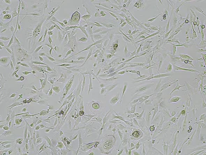 Brightfield micrograph of Immortalized Human Nasal Epithelial Cells, showing adherent growth, 4X magnification.