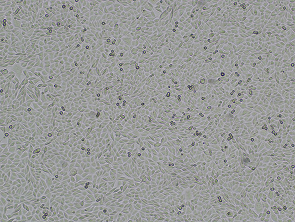 Brightfield micrograph of L-WRN, showing adherent growth.