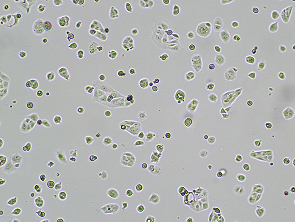 Brightfield micrograph of MKN-74 Luciferase Reporter Cell Line, showing adherent growth, 4X magnification.
