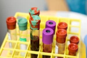 Human Peripheral Blood Macrophages