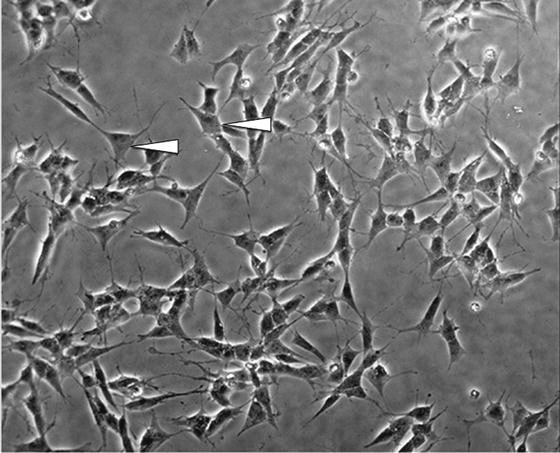 Differentiated SH-SY5Y cells