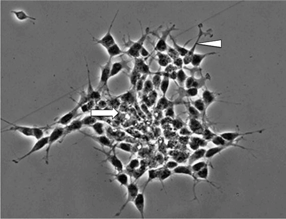 Undifferentiated SH-SY5Y cells