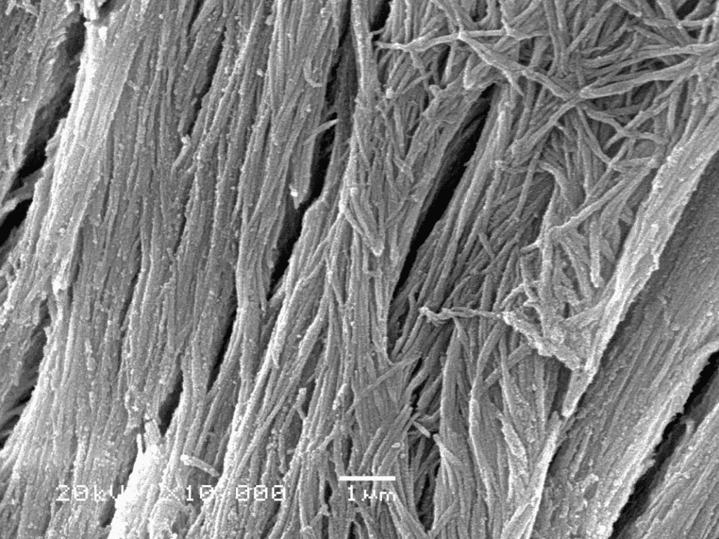 Bone Cancer and Bone Cancer Cell Lines