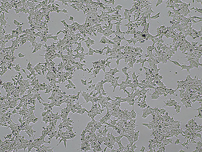 Brightfield micrograph of 22RV1 Luciferase Reporter Cell Line, showing adherent growth.