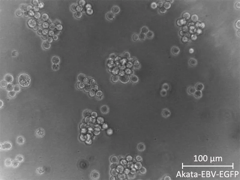 Akata-EBV-EGFP
